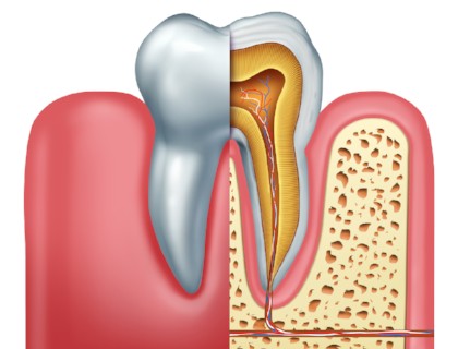 Endodontics & Root Canals in Abbotsford